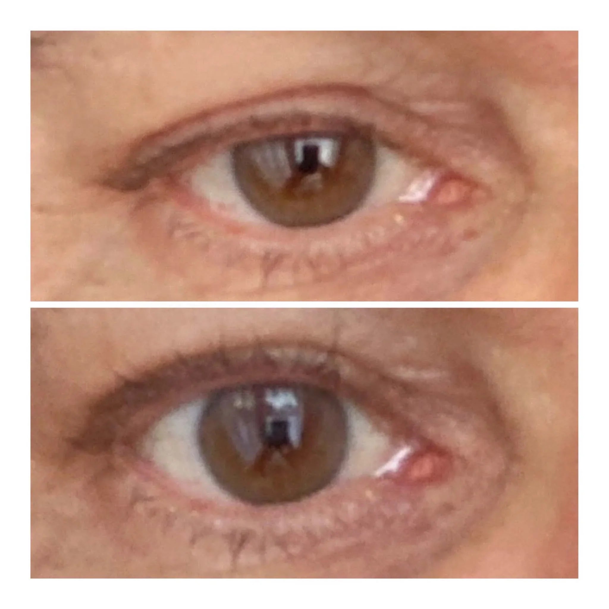 VARITA LIFTING DE OJOS