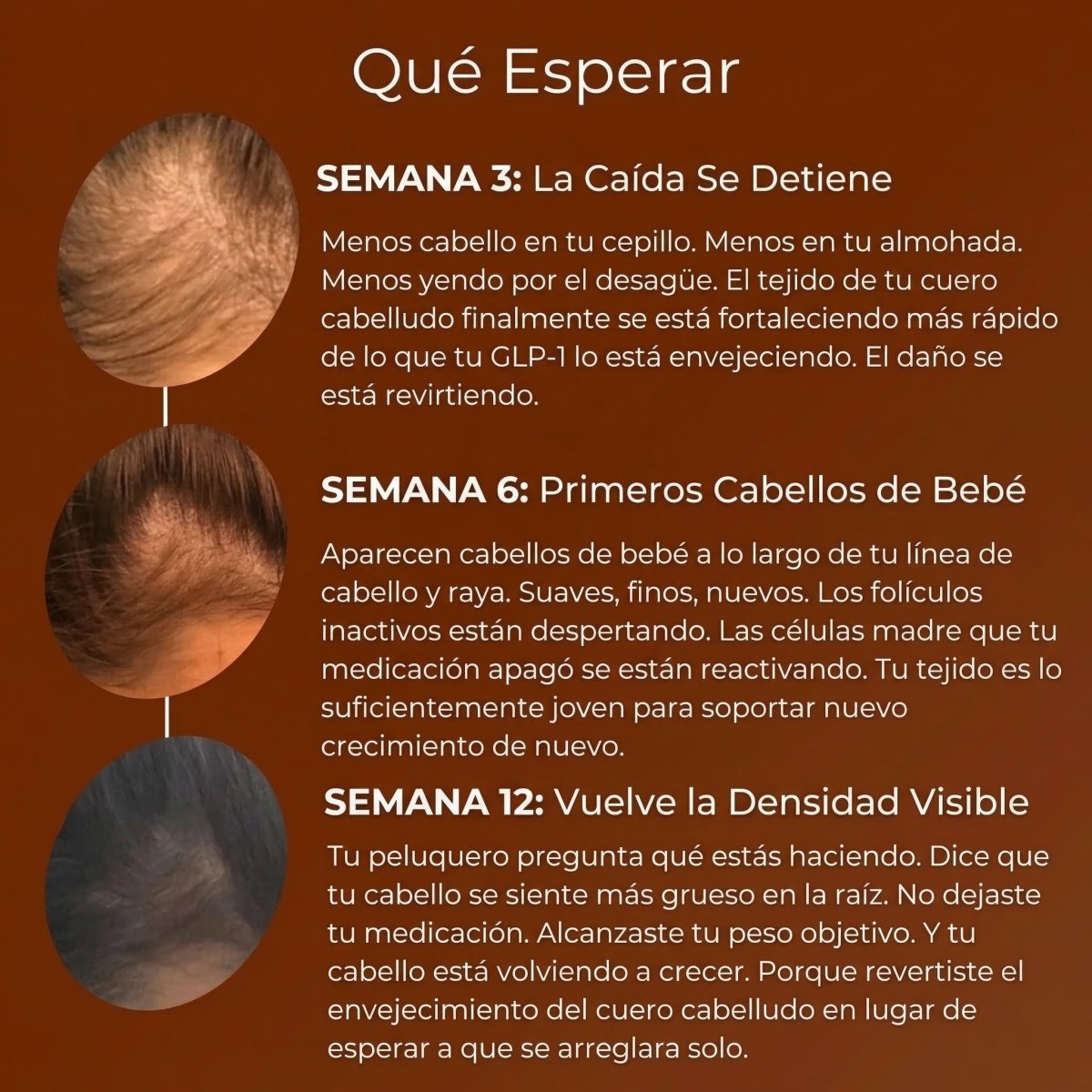 Detén la Caída de Cabello por GLP-1 y Recupera Tu Confianza
