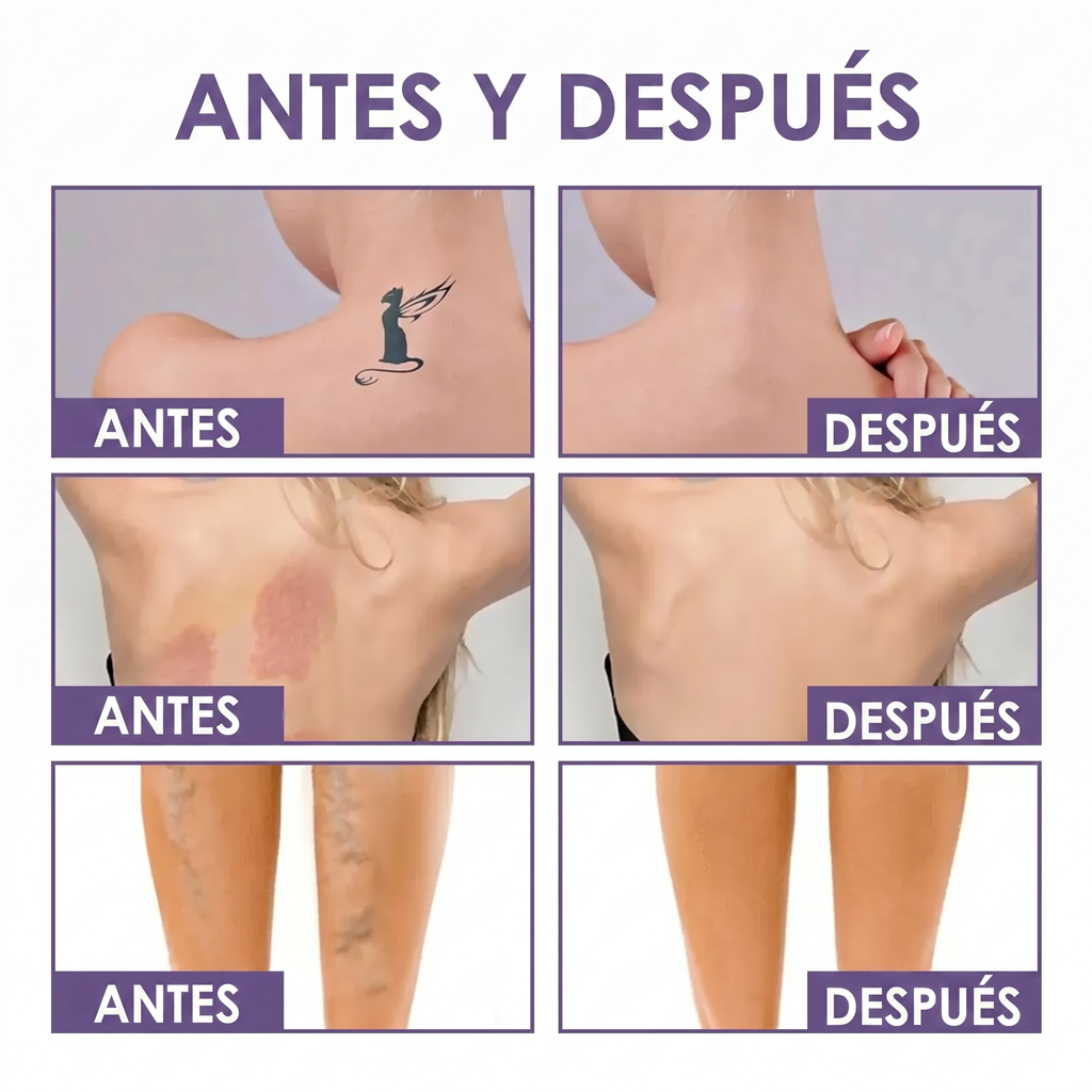 Perfeccionador Corporal