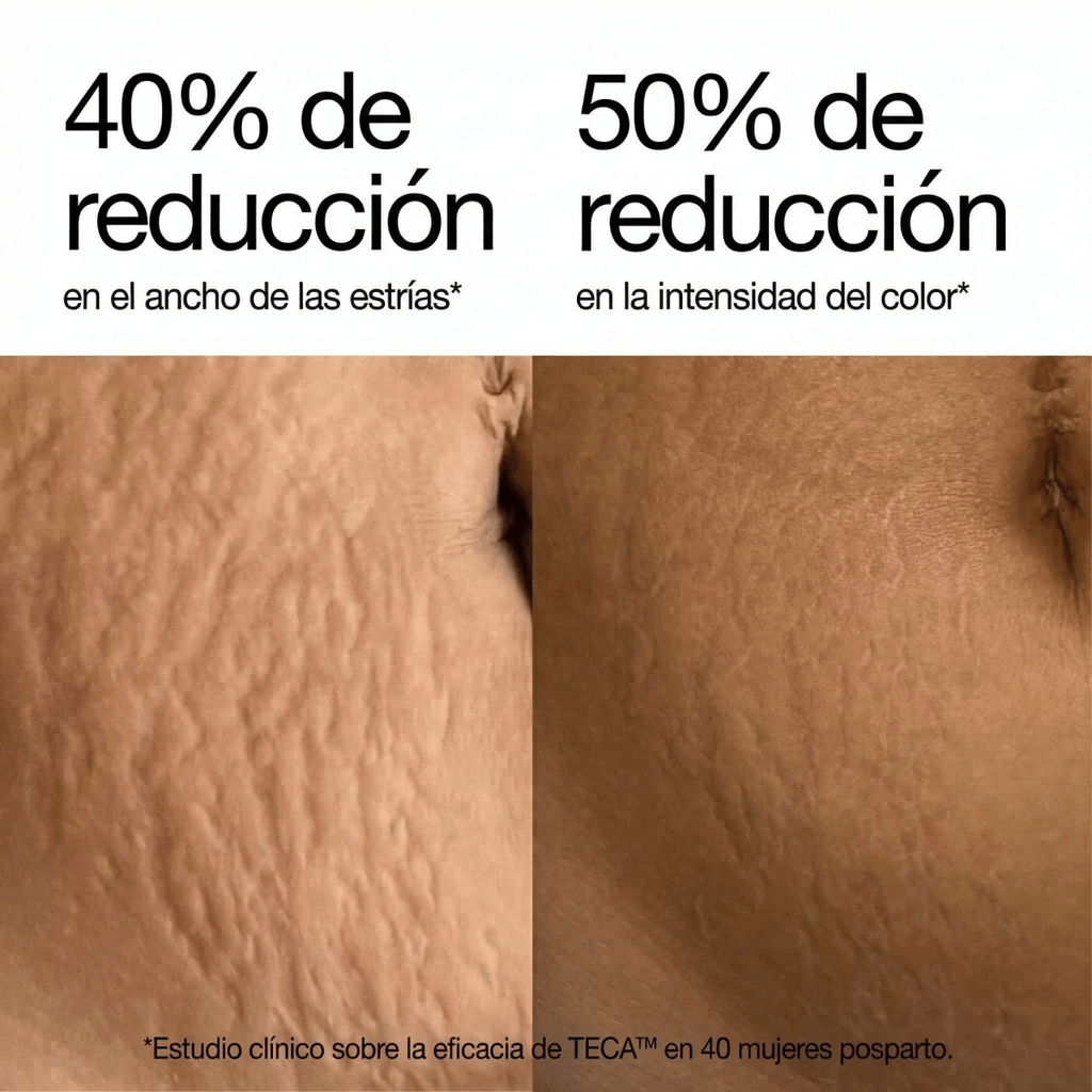 Redefiniendo la crema para estrías